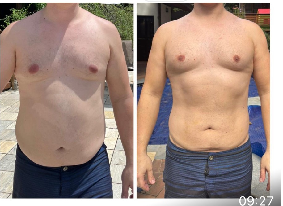Antes e depois — Protocolo Medida